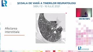 Afectarea pulmonara in vasculitele sistemice  Cristina Pamfil [upl. by Evey]