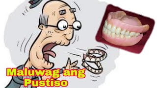 Solution At Remedy Maluwag na Pustiso Loose Dentures Ano ang Dapat Gawin kapag Maluwag ang Pustiso [upl. by Carver106]