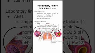 Respiratory failure in acute asthma [upl. by Iorio]