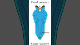 Neural tube defects clinical neuroanatomy neuroanatomy neuraltubedefects anatomy mbbslife [upl. by Rothwell]