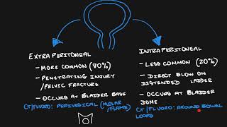 Urinary bladder rupture [upl. by Airotnes]