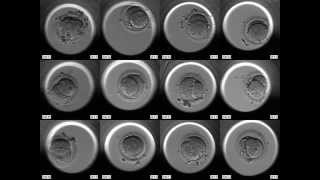 Embryoscope  Embryonen Entwicklung online [upl. by Carman]