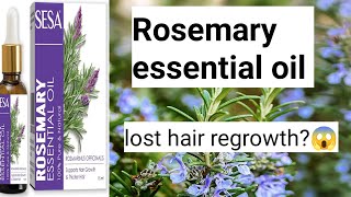 rosemary essential oil lost hair regrowth [upl. by Gregson825]