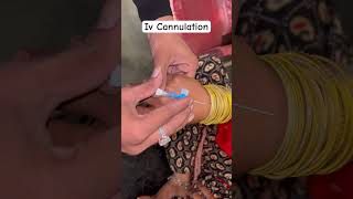 Iv cannula technique iv cannula kaise lagaya jata hai hospital doctor viralvideo Drxkaif0 [upl. by Issim601]