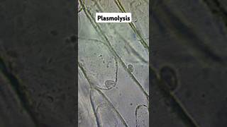 Plasmolysis and Osmosis biology gcse [upl. by Anilev]