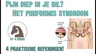 Fit4Riding  Piriformis syndroom [upl. by Wehttan]