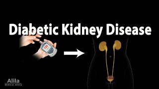 Diabetic Kidney Disease Animation [upl. by Landers]