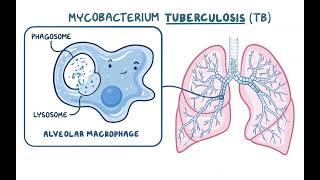 TB Pathology Infection [upl. by Elam870]