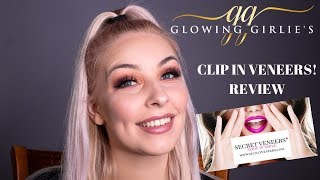 Clip in Veneers  Secret Veneers Review [upl. by Anitneuq19]