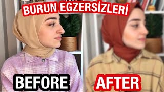 1 HAFTA BOYUNCA BURUN KÜÇÜLTME EGZERSİZLERİNİ DENEDİM  İNANILMAZ SONUÇ 😮👃🏻 [upl. by Ambros]