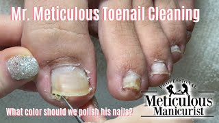 Shortn Sweet  Mr Meticulous Satisfying Impacted Toenail Cleaning [upl. by Annasus]