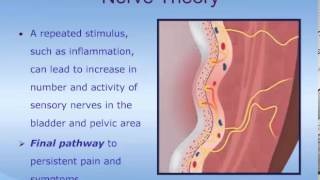 Understanding Interstitial Cystitis ICPainful Bladder Syndrome PBS [upl. by Rhea279]