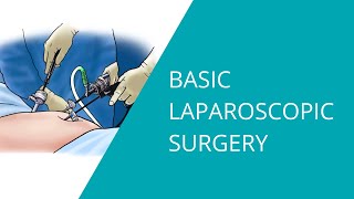 Basic Laparoscopic Surgery [upl. by Leoine412]