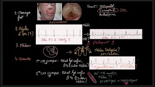 Traitement de lhypertension artérielle  Guidelines  Exercices  HTA  Docteur Synapse [upl. by Hwu893]