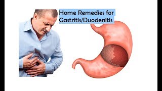 Home Remedies for Gastritis  Duodenitis  Doctors Hostel [upl. by Liddy]