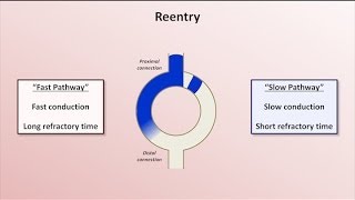 Intro to EKG Interpretation  Mechanisms of Tachyarrhythmias [upl. by Illah]