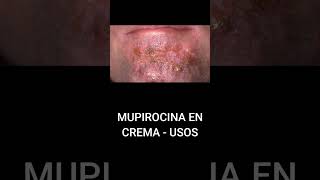 MUPIROCINA EN CREMA  USOS [upl. by Stilu597]