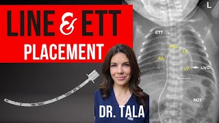 IDEAL Position of Endotracheal Tubes UACs and UVCs on Xrays [upl. by Christabelle]