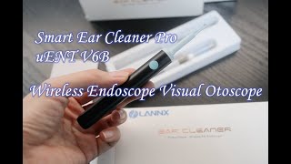 Wireless Endoscope Visual Otoscope Smart Ear Cleaner Pro Ear Spoon [upl. by Ecille]