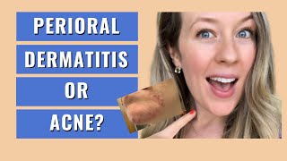 Perioral dermatitis treatment natural  TINY MOUTH BUMPS  ACNE OR PERIORAL DERMATITIS [upl. by Dam420]