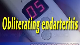 67 Obliterating endarteritis Symptoms of atherosclerotic lesions [upl. by Maddy153]