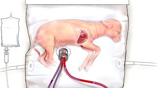 Un útero artificial mantiene con vida a fetos de animales prematuros [upl. by Doniv24]