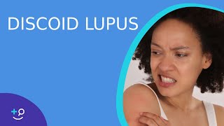 Discoid Lupus  Daily Dos of Dermatology [upl. by Nalyd191]