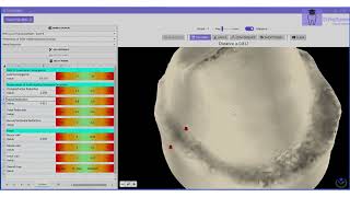 Dental Prep Grading via PrepScanner™ Robotic Precision Laser Tech amp 3D Visuals [upl. by Yarahs364]