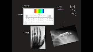 Rayons X  Radiographie  TST2S [upl. by Meghan335]