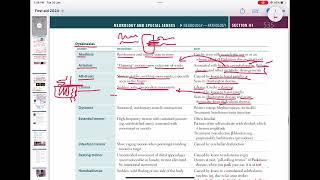 Movement disorder  Akathisia asterixis Athetosischorea  neurology 113  First Aid USMLE [upl. by Gemina]