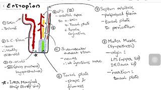 Entropion  with Lid Anatomy amp Surgical Management [upl. by Avid]