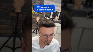 Konya saç protezi konyaprotezsaç haircut protezsac [upl. by Atekahs385]