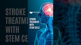 Stem Cells for Stroke Recovery stemcell stroke shorts [upl. by Fey]