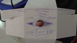 Body of Sphenoid Anatomy [upl. by Sadirah791]