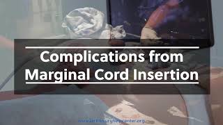 Marginal Umbilical Cord Insertion [upl. by Maddis]