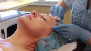 Micropeel Demonstration [upl. by Elocan]