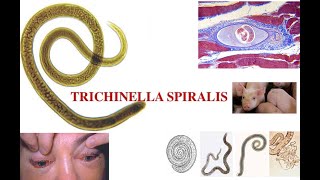 Triquinella spiralis [upl. by Nnaes288]