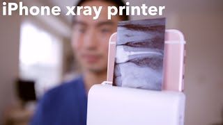 iPHONE XRAY PRINTER for DENTISTS [upl. by Acherman]