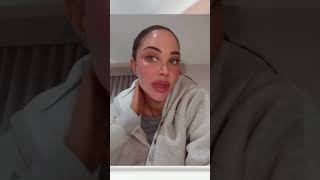 Tulisa Contostavlos Seeks Fat Transfer to Address Facial Bruising Caused by Steroid Injections [upl. by Geilich]