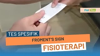 Froments sign [upl. by Reseda]