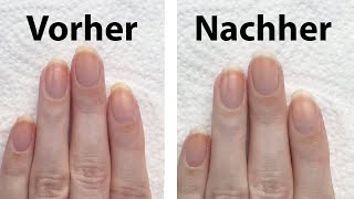 3 Tipps im Test um vergilbte Fingernägel aufzuhellen  seni Nageldesign [upl. by Uund371]