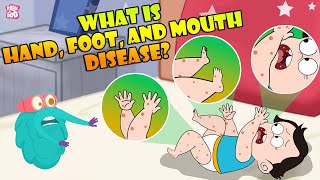 What Is Hand Foot And Mouth Disease  Infection In Children  The Dr Binocs Show  Peekaboo Kidz [upl. by Figone]