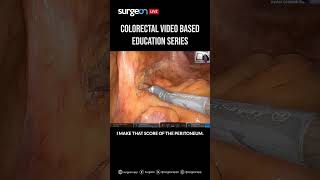 Hindgut Session 2 Mastering the Left Colon Mobilization Dissection Resection and Troubleshooting [upl. by Hermia]