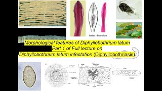 Morphological features of Diphyllobothrium latumFish tapewormlargest tapeworm of human [upl. by Alset]