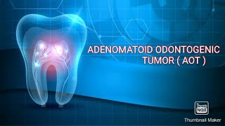 AOT  ADENOMATOID ODONTOGENIC TUMOR  Adenoameloblastoma [upl. by Whitford139]