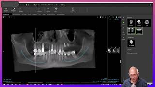 Dental Treatment Planning in a Medically Compromised Case [upl. by Ihsar858]