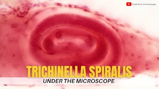 Trichinella spiralis under the microscope [upl. by Inahteb]