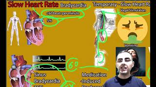 Slow Heart Rate Causes Bradycardia Causes Bradycardia symptoms signs and treatment [upl. by Clayson]