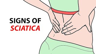 Signs of Sciatica [upl. by Padraic953]