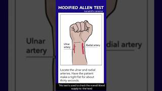 Modified Allen Test  Positive and Negative Allen Test allentest [upl. by Asenaj]